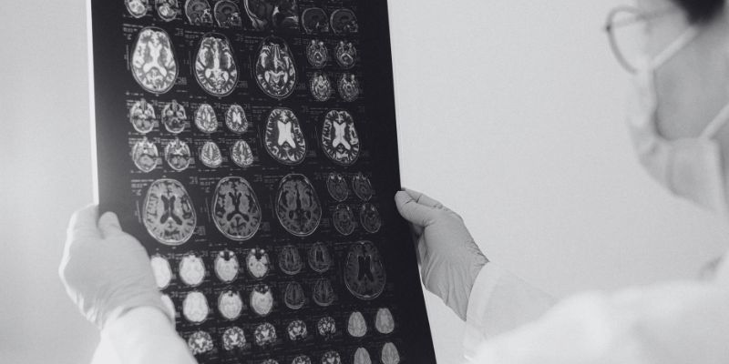 Stages of Alzheimer’s Disease: What to Expect and When to Consider Memory Care